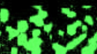 Jackie Banes enjoys wand orgasms in exam.