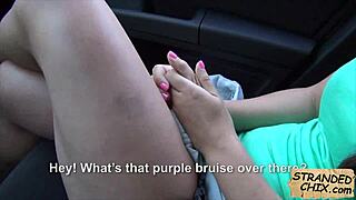 Wow, hot nurse Black Angelika gets anal fucked by patient!