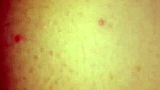 Real Couple's Epic Slip And Stretch 😍