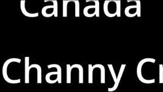 I had my dental checkup in Canada, and the doctor used gloves backstage behind the scenes