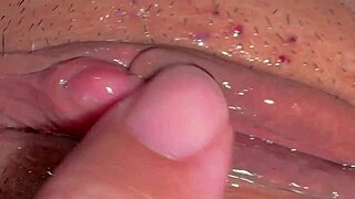 amateur checks pink area 310 days post first time