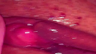 amateur checks pink area 310 days post first time