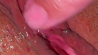 amateur checks pink area 310 days post first time