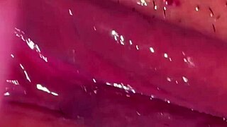 amateur checks pink area 310 days post first time