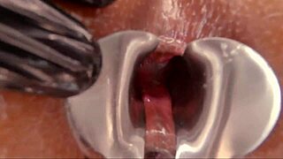 Amari Gold's Ass Fist-Gaped to Extreme Stretching!