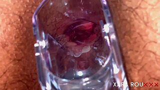 huge gaping ass speculum stretches mature bbw's tight hairy hole wide