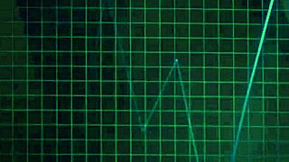 Christina Sage And Penelope Reed Suck Doctor's Cock In Threesome Facial Finish